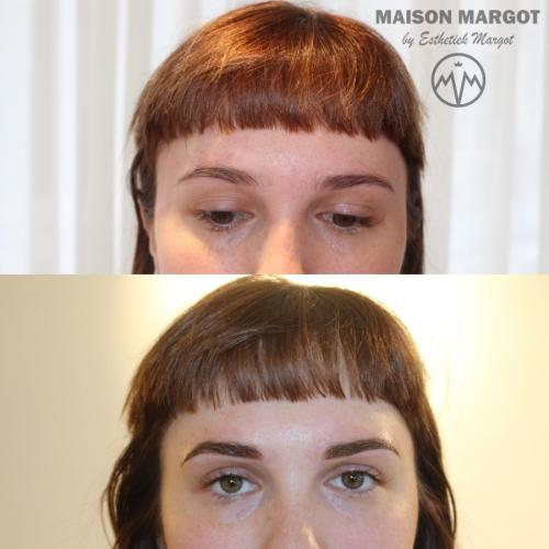 Voor en na powderbrows