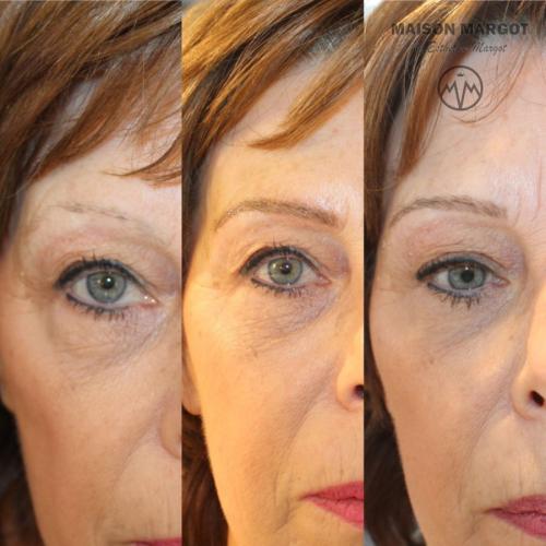 Voor en na microblading