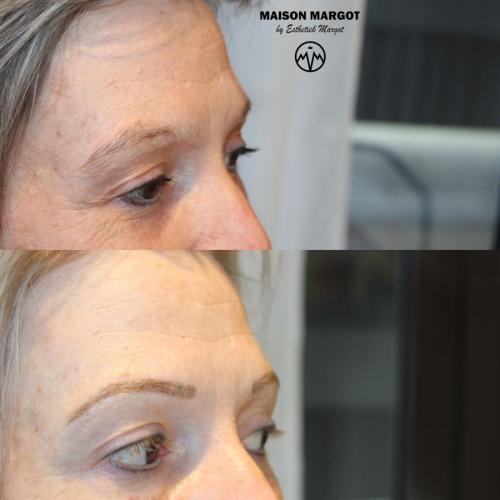 Voor en na microblading